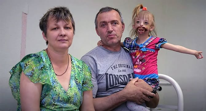 Изоставена като бебе заради рядко заболяване без челюст и уста – днес никой не може да повярва как изглежда! 15 495035791 670813982361170 2164898557281655258 n