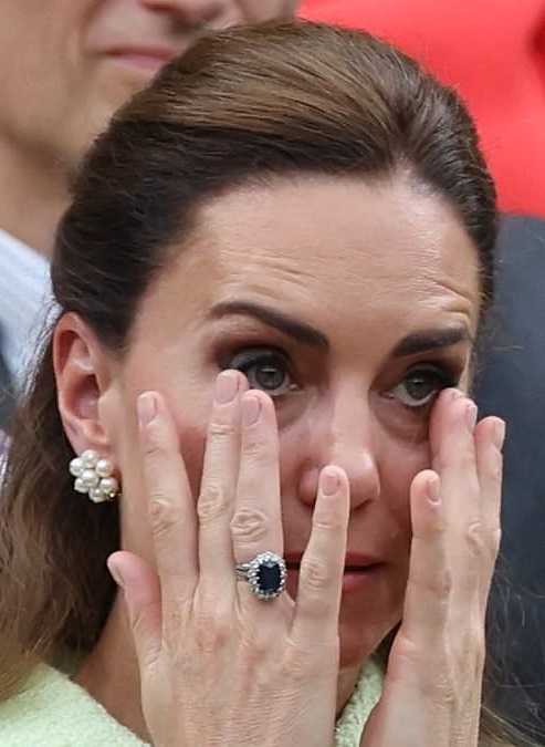 lekari s izvnredni novini za kejt midltn