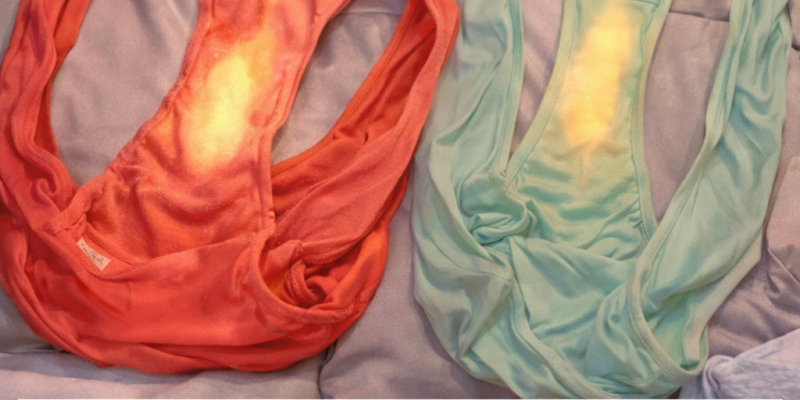 ako beloto na sprugata vi ima takiva petna eto kakvo oznachava