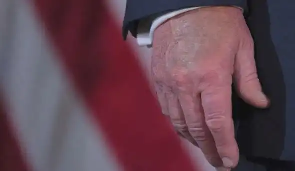 1770712377 39 izvnredno diagnosticziraha trmp s bolestta na…