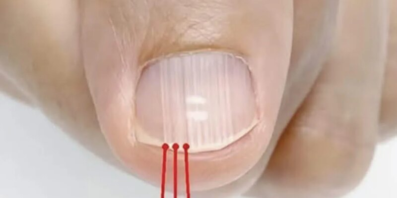 ako imate takiva linii po noktite tova e yaven priznak