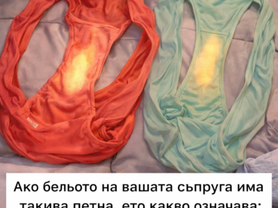 ako beloto na sprugata vi ima takiva petna eto kakvo oznachava