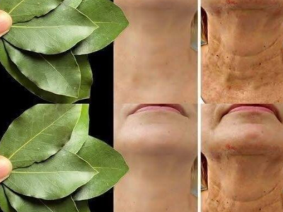 Дафиновият лист е 100 000 пъти по-мощен от ботокс. Той премахва всички бръчки, дори и на 70-годишна възраст. Рецептата е в първия коментар 25 screenshot 29 15