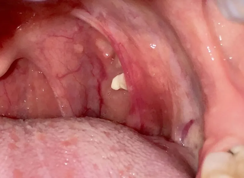 1776841555 744 dnes kashlyah i ot grloto mi izleze stranna byala buchka