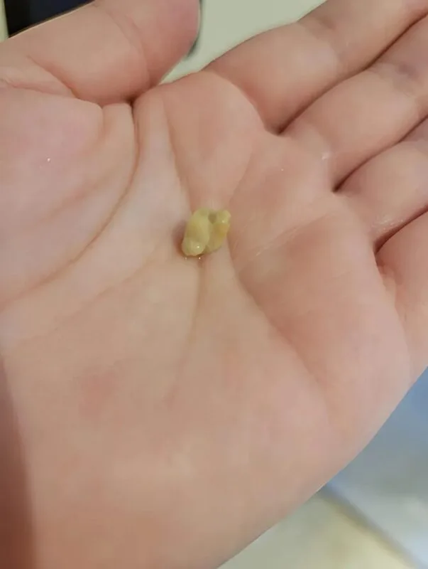 1776841555 753 dnes kashlyah i ot grloto mi izleze stranna byala buchka