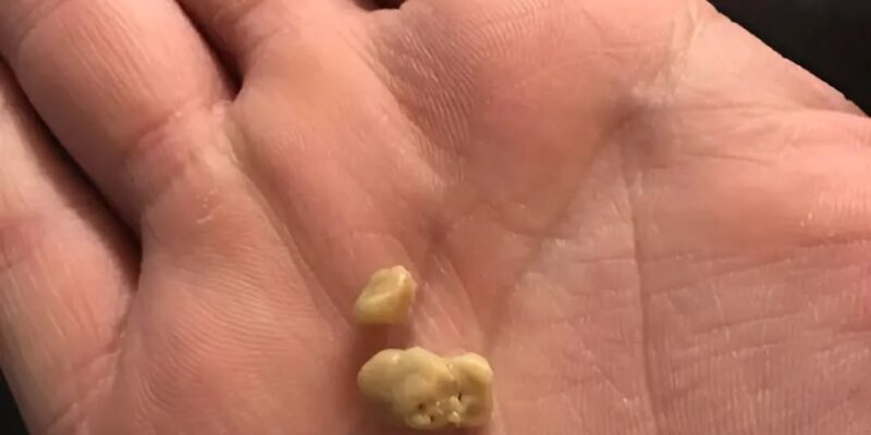 dnes kashlyah i ot grloto mi izleze stranna byala buchka