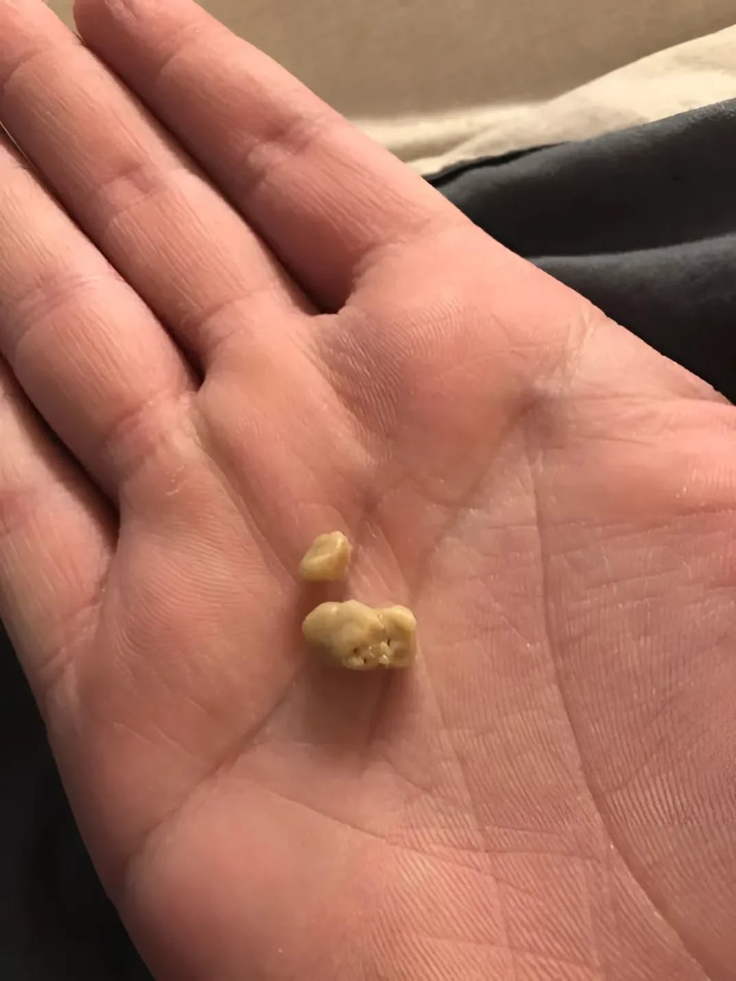 dnes kashlyah i ot grloto mi izleze stranna byala buchka